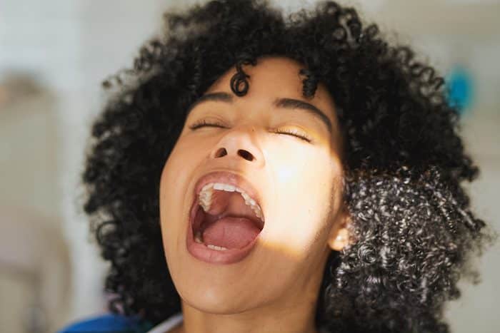 What Is a Tonsil Stone